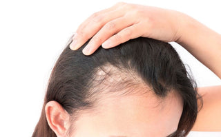 Can Biotin Shampoo Help With Hair Shedding?