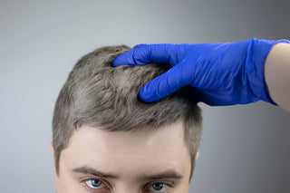 Does Root Touch-up Cause Hair Loss?