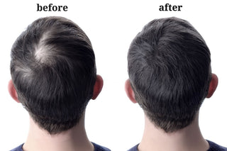 How to Stop Hair Loss and Regrow Hair Naturally – Biotin Xtreme Hair Care