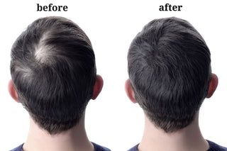 How to Stop Hair Loss and Regrow Hair Naturally