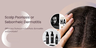 Scalp Psoriasis or Seborrheic Dermatitis? How to Know Your Hair Issue?